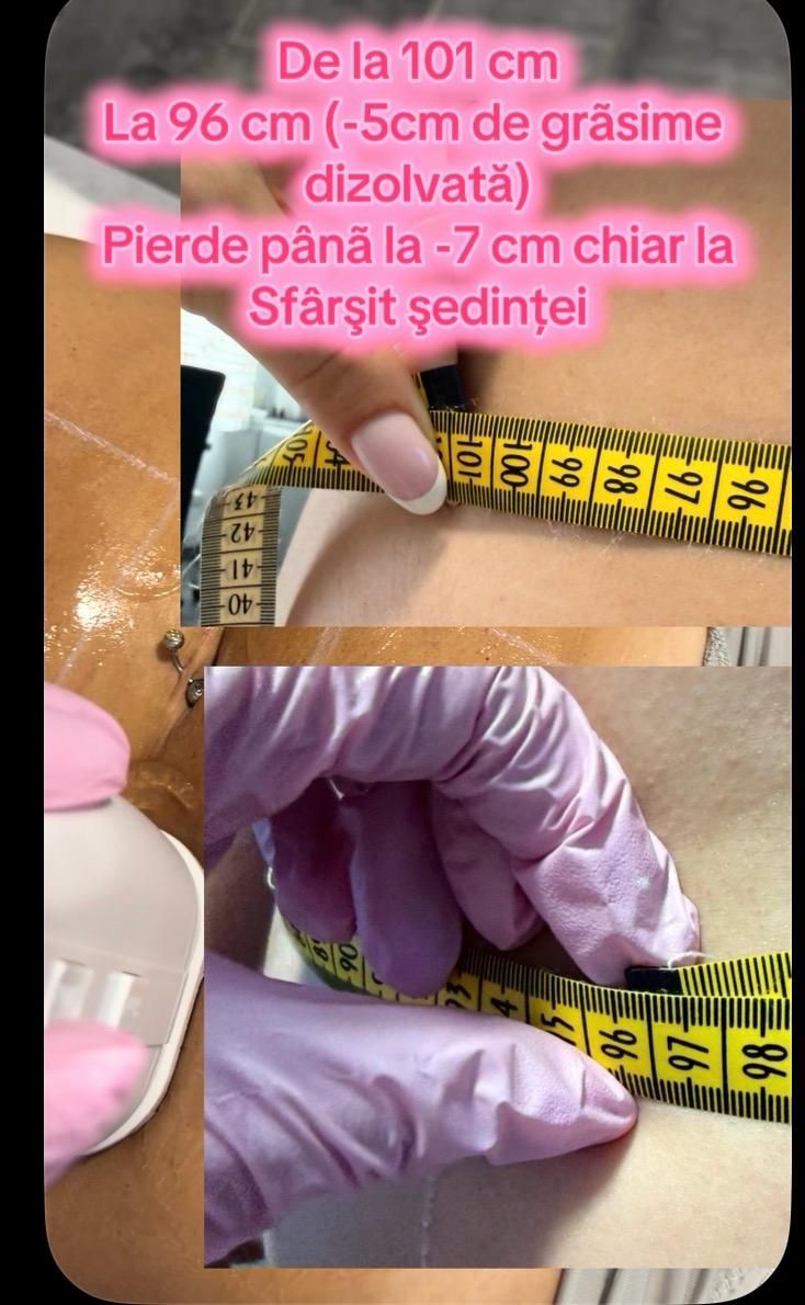 Remodelare corporală: de la 101 cm la 96 cm